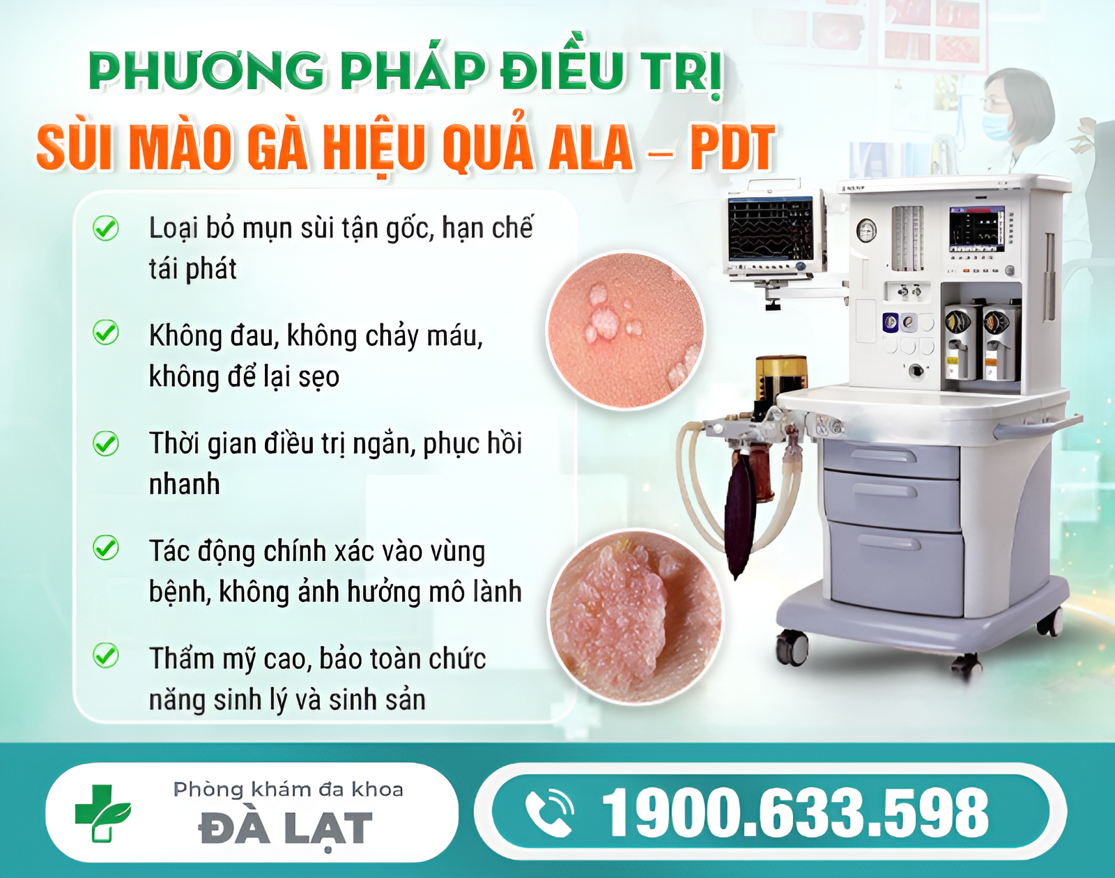 Hình ảnh minh họa